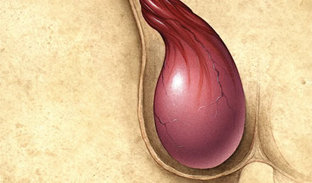 Assessment and Management of Scrotal Disorders Assessment and Management of Scrotal Disorders