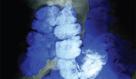 Management of Patients Presenting with Constipation Management of Patients Presenting with Constipation
