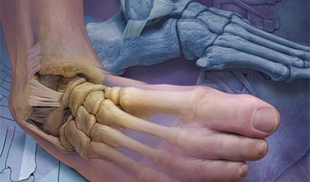 Acute Ankle Injuries in the Urgent Care Setting Acute Ankle Injuries in the Urgent Care Setting