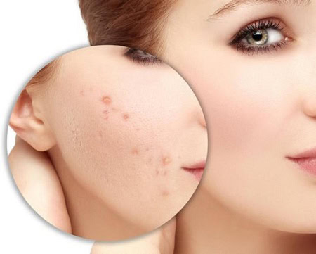 Top 7 Kem trị SẸO tốt nhất hiện nay giúp ĐÁNH BAY mọi thể loại sẹo Top 7 Kem trị SẸO tốt nhất hiện nay giúp ĐÁNH BAY mọi thể loại sẹo