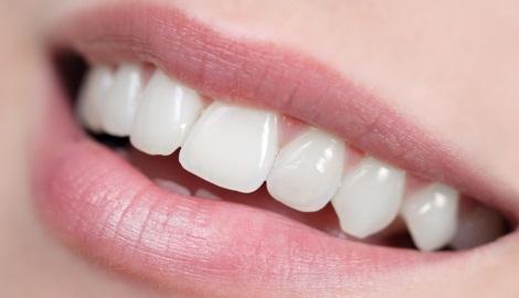 Blanchiment dens dentiste richard amouyal