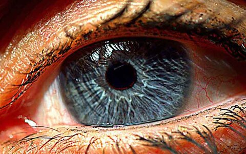oeil bionique