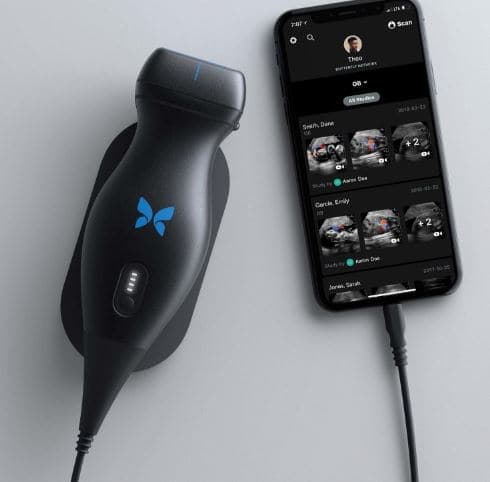 The iQ Portable Ultrasound