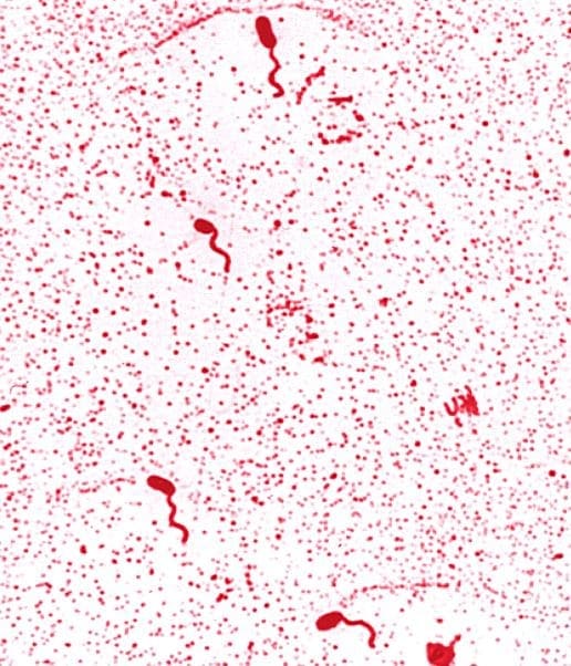 Vibriosis