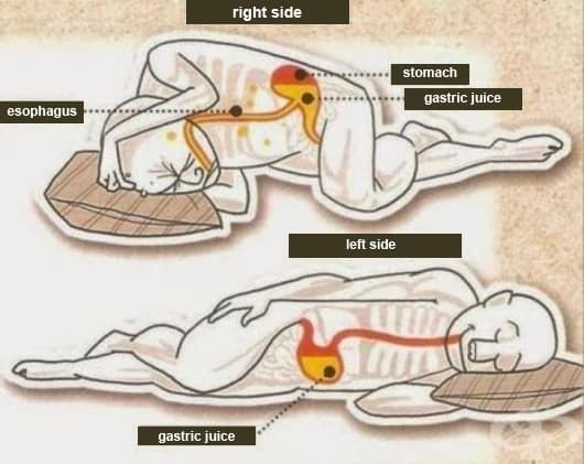 lay on your left side after overeating, stomach and esophagus position