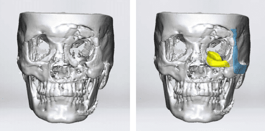 Scan of the patient