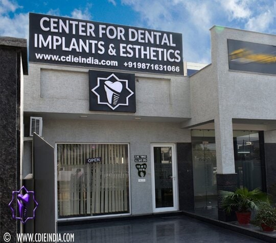 Dental Implants in Gurgaon