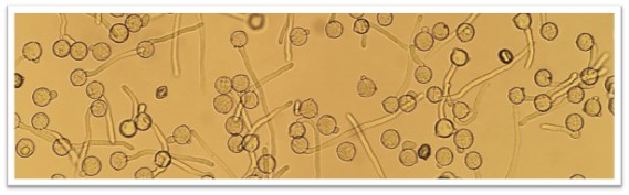 Germinating and non-germinating tomato pollen