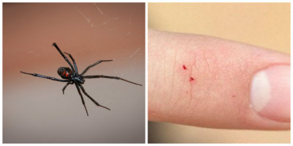 How To Identify A Spider Bite And Treat It Trueprepper