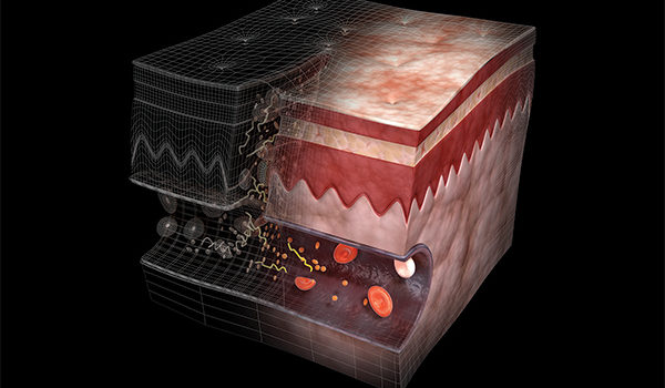 Nonhealing Wounds, Part 1: Diagnosis in the Urgent Care Center Nonhealing Wounds, Part 1: Diagnosis in the Urgent Care Center
