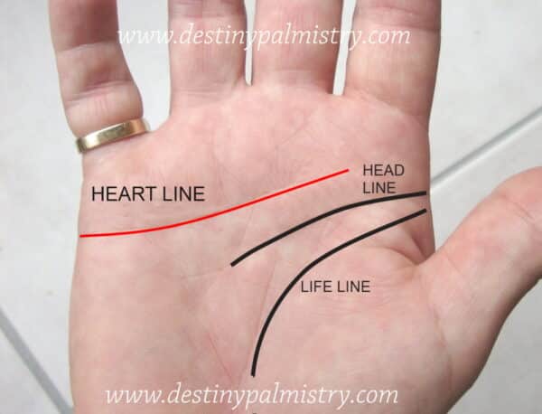 normal heart line