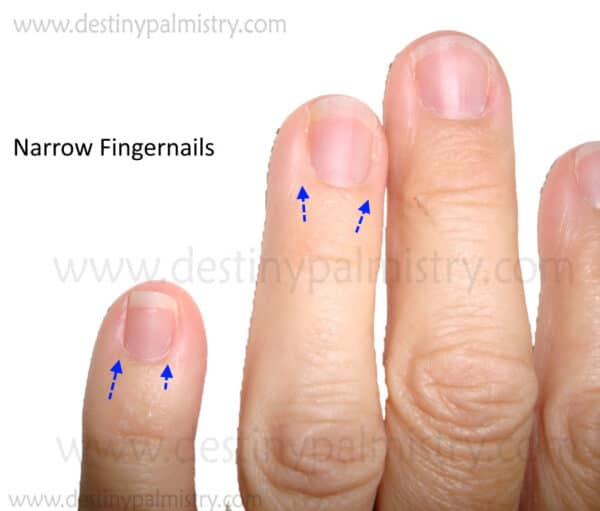 narrow fingernail