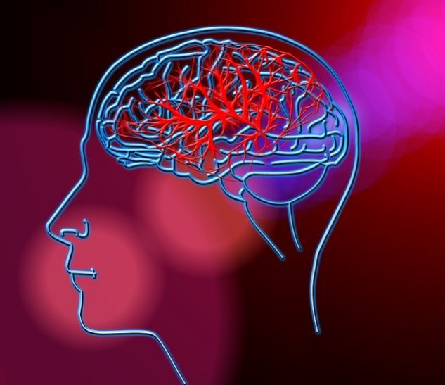 Brain Stroke