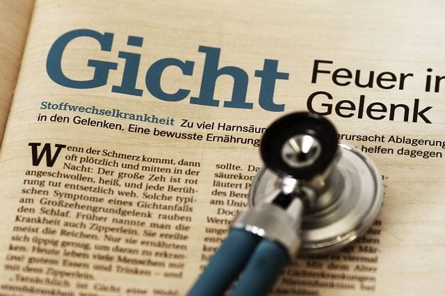Gicht Gicht ist eine Stoffwechselerkrankung und verläuft in Schüben. Dabei lagern sich Harnstoffkristalle in Gelenke und Gewebe ab was zu Knorpelveränderungen führt. Darüber hinaus entsteht langfristig eine Schädigung der Niere.