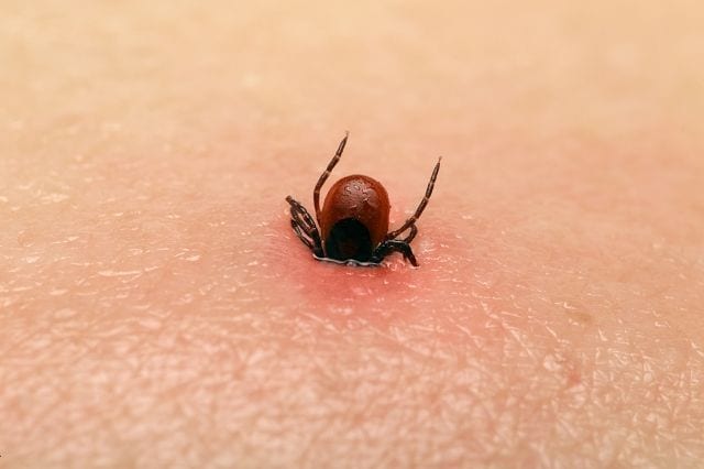 Zeckenbiss Wird eine Infektion nicht bemerkt und behandelt kann nach Monaten oder gar Jahren zu einem Befall der Gelenke oder des zentralen Nervensystems kommen.