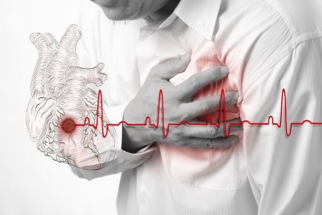 herzinfarkt Ein Herzinfarkt kann neben den bekannten Symptomen wie Schweißausbrüche, ziehen in der Brust, Übelkeit und ein Engegefühl von starken Rückenschmerzen begleitet werden.