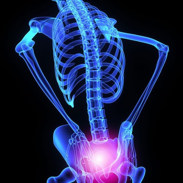 Symptome ISG Therapien wie spezielle physiotherapeutische Übungen, Mobilisation oder Manipulation, Wärmeanwendungen, Schmerzmittel, Akupunktur, Triggerpunktmassage, Anwendung einer Akupressurmatte, anwendbare Behandlungen.