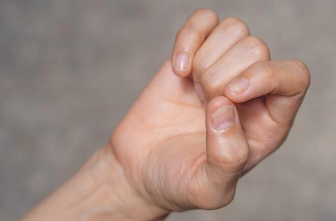 "nail psoriasis and how to treat it"