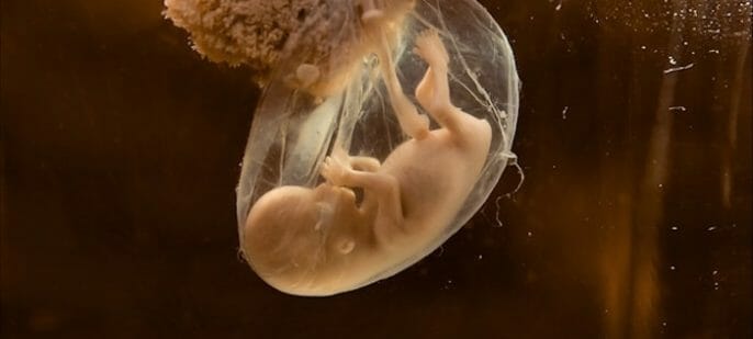 Warum diagnostizieren Ärzte manchmal keine Eileiterschwangerschaft und was tun?