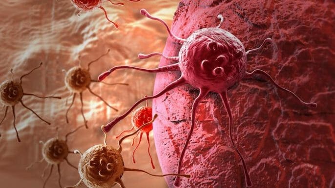 Nur ein PSA-Test im mittleren Alter kann das zukünftige Prostatakrebsrisiko vorhersagen