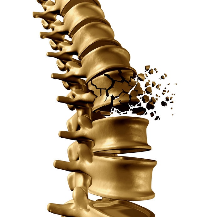 Osteoporosis Spine