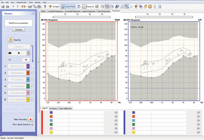 Speech Mapping