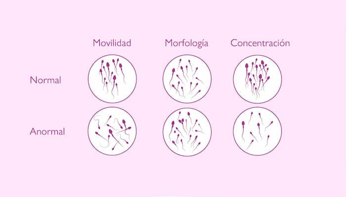 Semen normal y anormal
