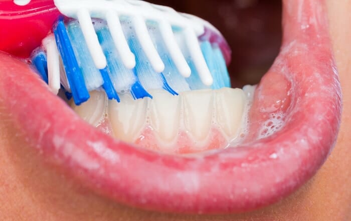 Cuidado bucal durante el tratamiento del cáncer: cómo cuidar la boca y los dientes