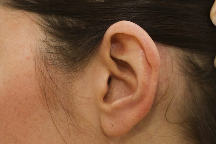 Las jeringas de bulbo son una herramienta efectiva para la eliminación de cerumen