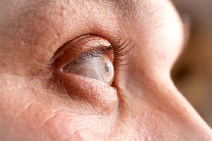 ¿Cómo se maneja el síndrome de la enfermedad de Lyme después del tratamiento (enfermedad de Lyme crónica)?