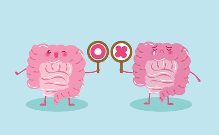 Condiciones intestinales inflamatorias