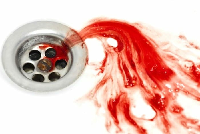 ¿Deberías preocuparte por la sangre en tu saliva?