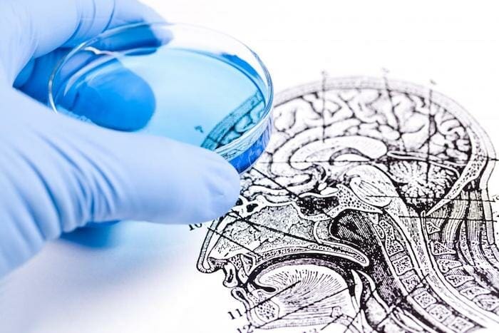 Los investigadores ahora saben qué hace que las células de glioblastoma tengan una vida tan larga.