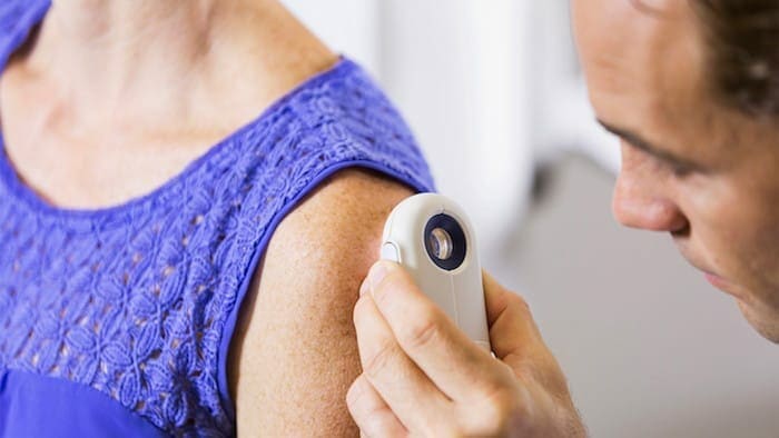 A interação entre duas proteínas específicas pode ser responsável pela disseminação do melanoma, de acordo com um novo estudo