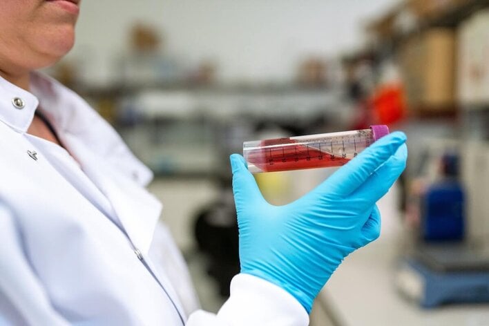 chemical engineering degree