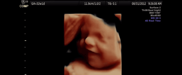31 week old baby