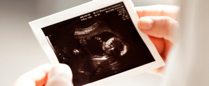 Woman holds ultrasound image in her hands // pro-life policy
