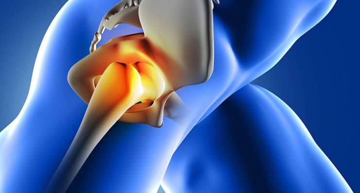 Hip, Buttock and Thigh Pain