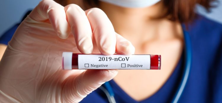 Evaluation of a Point-of-Care COVID-19 Testing Platform Using Self-Collected Nasal Swabs in an Urgent Care Setting Evaluation of a Point-of-Care COVID-19 Testing Platform Using Self-Collected Nasal Swabs in an Urgent Care Setting