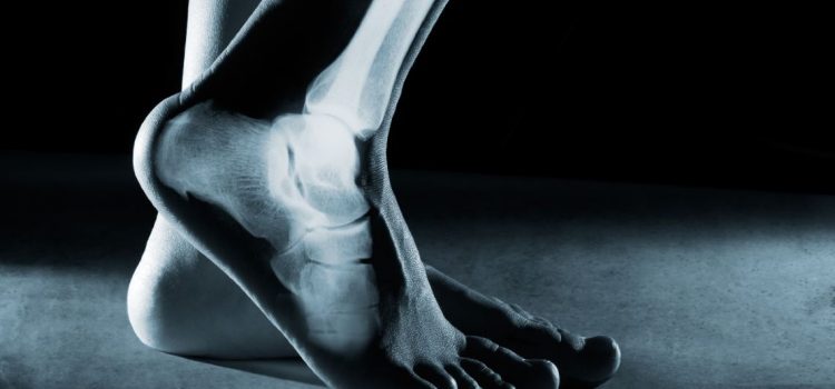 The Implementation of Nurse-Intiated Ankle and Foot X-rays in an Urgent Care Setting The Implementation of Nurse-Intiated Ankle and Foot X-rays in an Urgent Care Setting