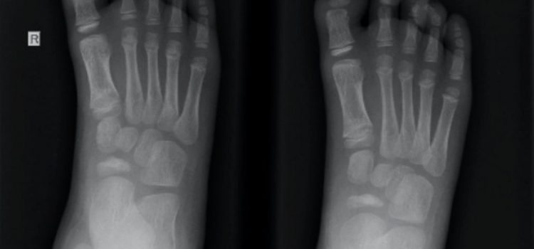 A 5-Year-Old with Foot Pain of Unknown Origin A 5-Year-Old with Foot Pain of Unknown Origin
