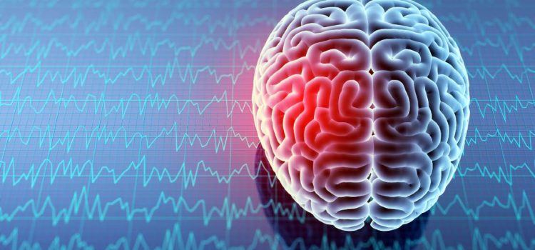 Managing Concussions in Acute Care Managing Concussions in Acute Care