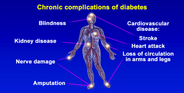 can-type-2-diabetes-be-reversed can type 2 diabetes be reversed permanently