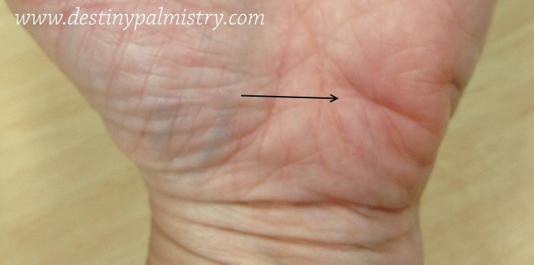 allergy line, palmistry online