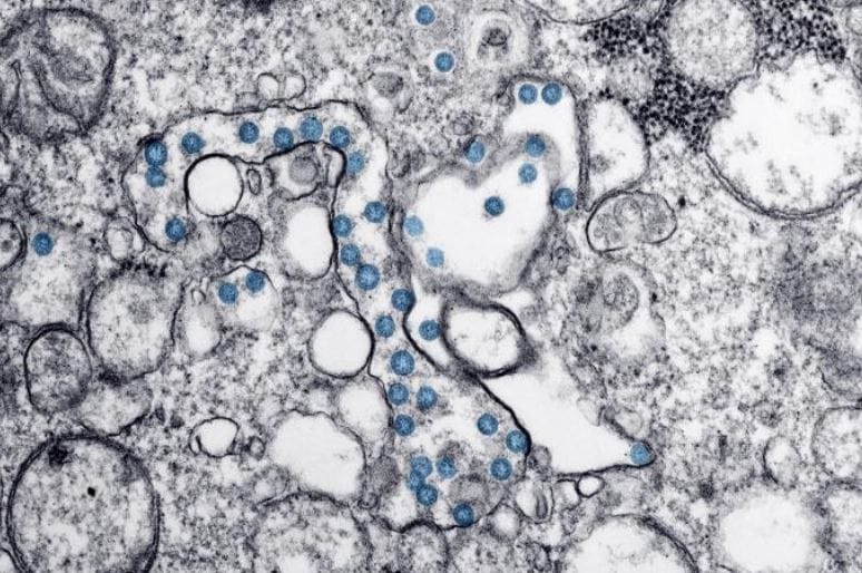 COVID-19-Electron Microscope