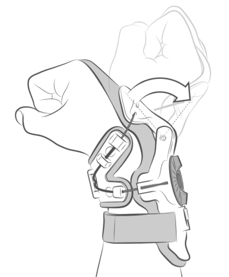 X8 WRIST BRACE how the mobius wrist brace works