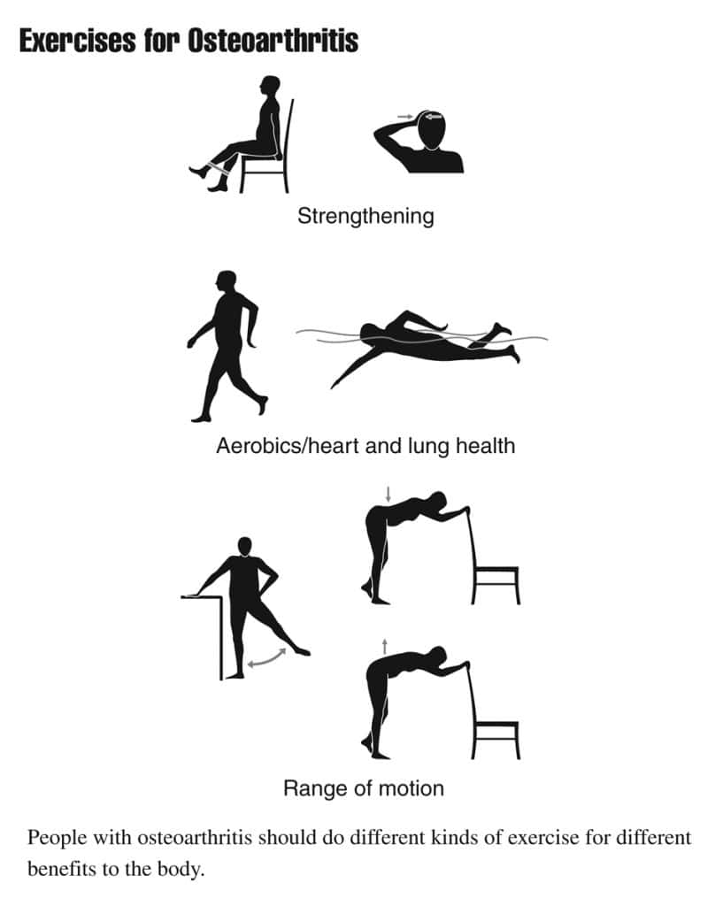 Osteoarthritis Exercises