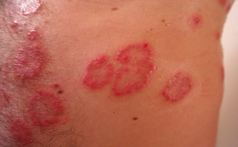 Homeopaat Oldenzaal Archieven Pagina 6 Van 22 Zemi