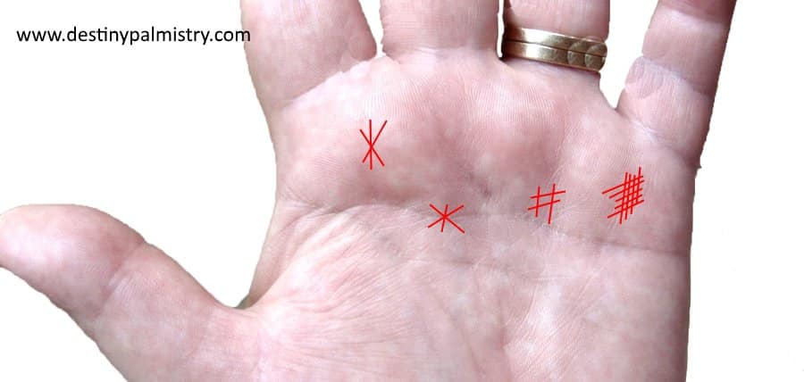markings on palm, star on palm, grille mark on palm