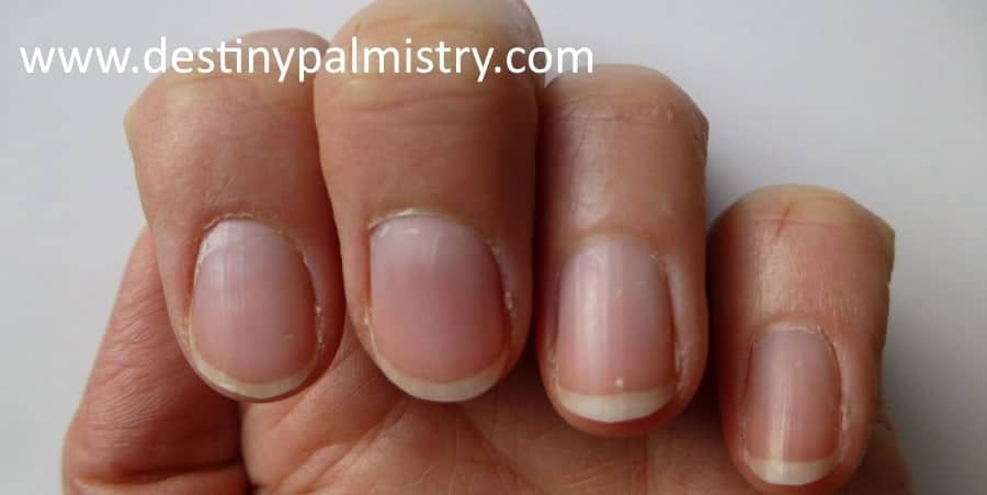 Fingernail Ridges Spots and Lines - Destiny Palmistry